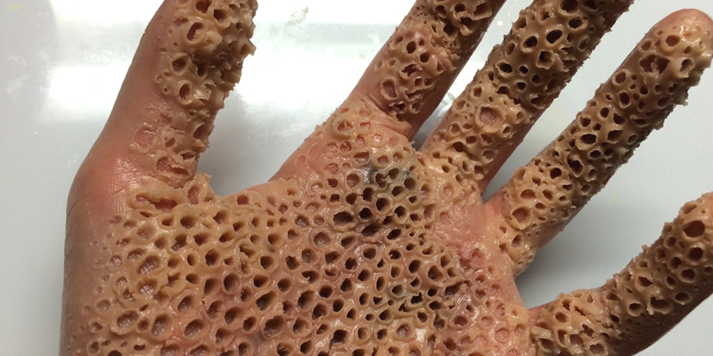 Miedo a los agujeros – tripofobia Miedo a los agujeros – tripofobia